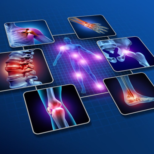 Digital Graphic of common pain areas