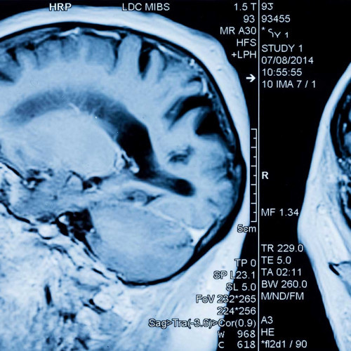 Brain Scan