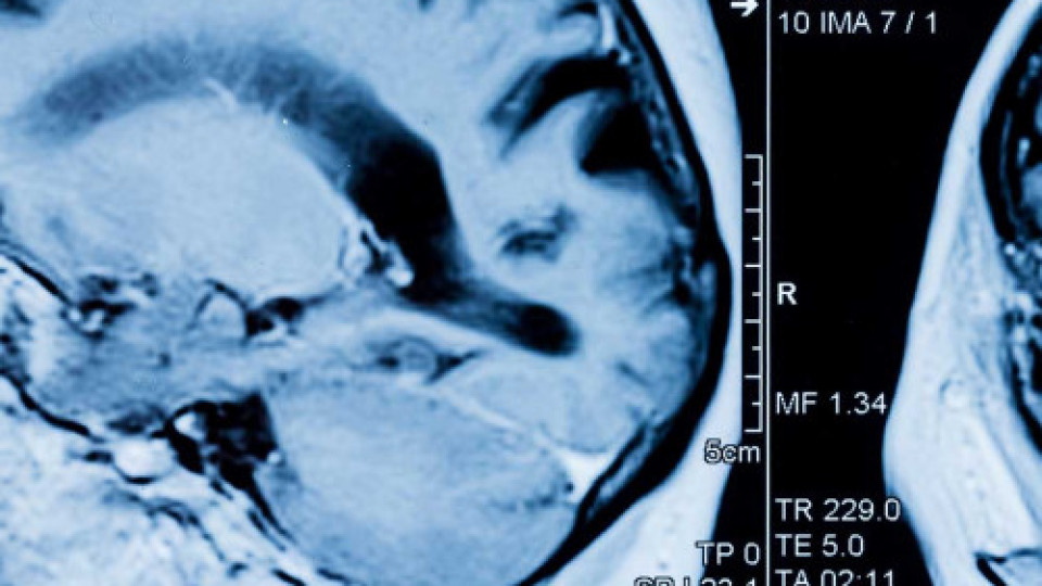 Brain Scan